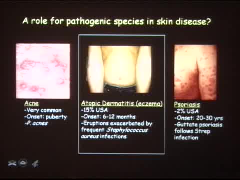 Preview of Diversity Profile of the Human Skin Microbiome in Health and Disease Elizabeth A. Grice, National Institutes of Health